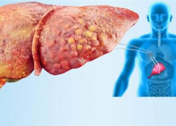 احذر من نزيف الأنف المستمر.. أبرز أعراض هذا المرض…!؟