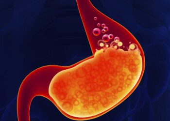 دراسة تكشف سبباً غريباً لحموضة المعدة