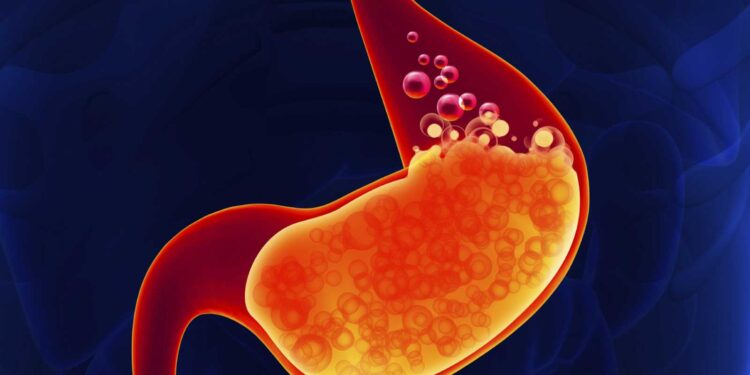 دراسة تكشف سبباً غريباً لحموضة المعدة