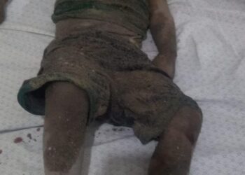 غزة.. جثمان شهيدة طفلة محترق