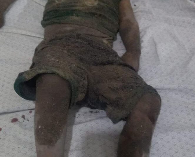 غزة.. جثمان شهيدة طفلة محترق