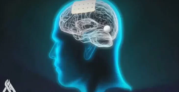 اكتشاف جديد يفتح آمالا لفاقدي النطق