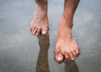 #منوعات.. أطباء: الأقدام المبللة من أسباب مشاكل القلب