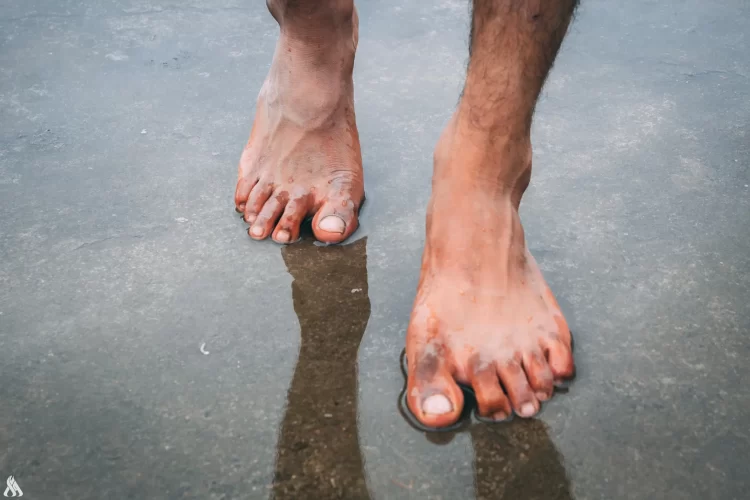 #منوعات.. أطباء: الأقدام المبللة من أسباب مشاكل القلب