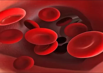 علامات وأعراض تصيب الجسم نتيجة نقص الحديد