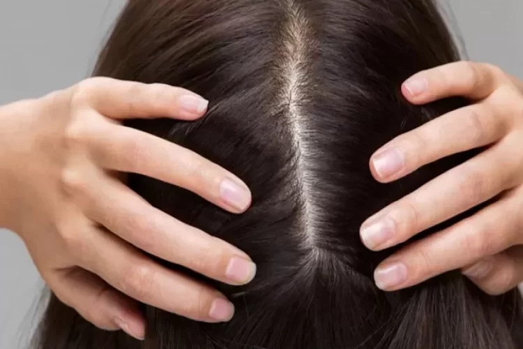 جفاف الجلد وحكة الرأس.. دليل على الإصابة بمرض خطير