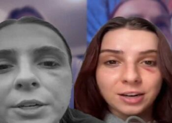 مجهول يعتدي على النساء في شوارع نيويورك!