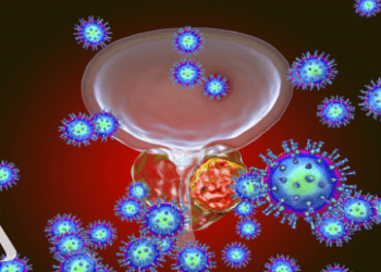 تفشي مرض السعال الديكي في استراليا
