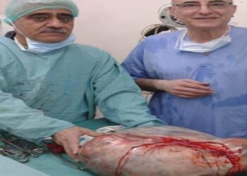 فريق طبي في الحسكة يستأصل كتلة زنة 13 كيلوغراماً من بطن شابة