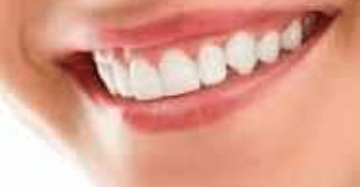 استغنت عن زيارة طبيب الأسنان لمدة 40 سنة… هذا ما نصحت به إحدى خبيرات صحة الفم!