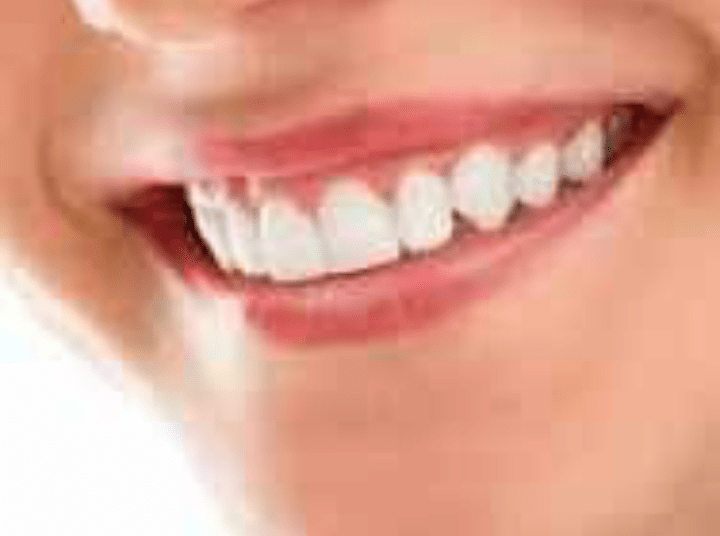 استغنت عن زيارة طبيب الأسنان لمدة 40 سنة… هذا ما نصحت به إحدى خبيرات صحة الفم!