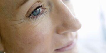 أربع نصائح لتجنب التجاعيد حول العين