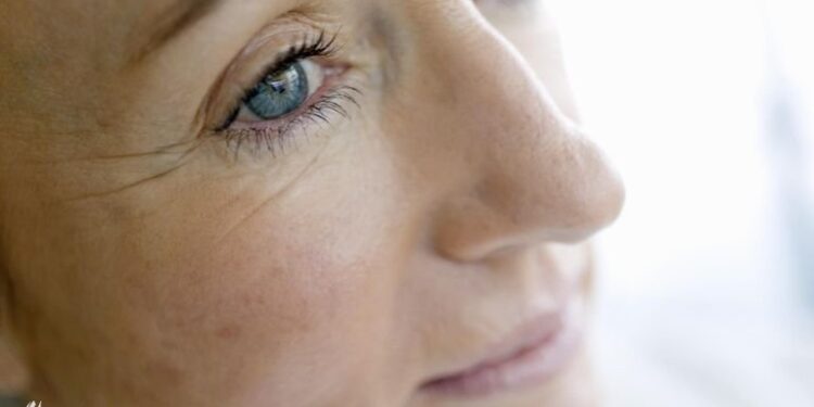 أربع نصائح لتجنب التجاعيد حول العين