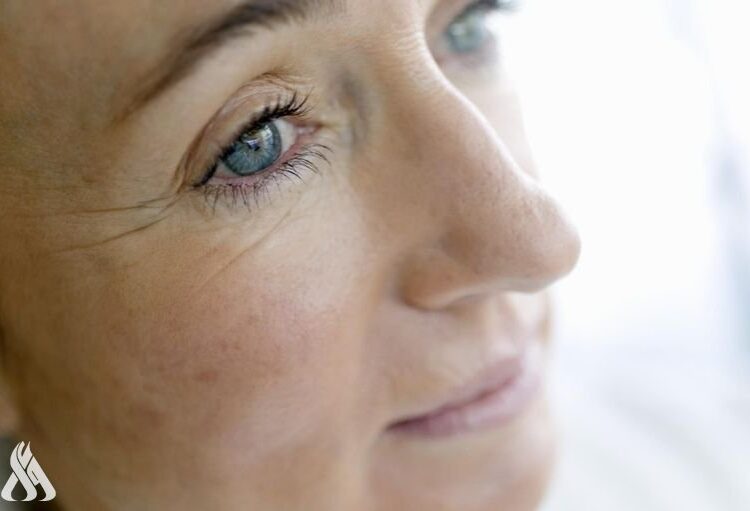 أربع نصائح لتجنب التجاعيد حول العين