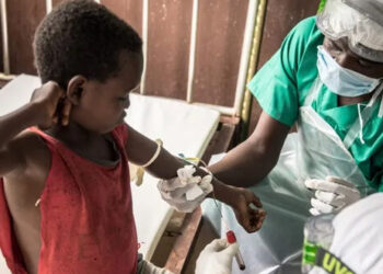 جمهورية الكونغو الديمقراطية تسجل 548 وفاة بجدري القردة منذ مطلع العام