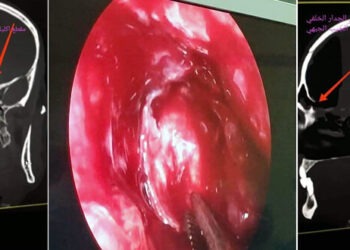 نجاح عمل جراحي نوعي في مشفى الباسل بطرطوس