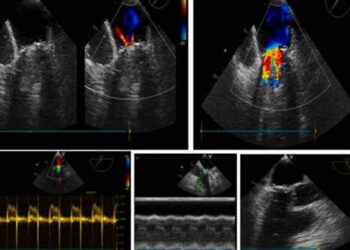 في مشفى الباسل لأمراض وجراحة القلب بدمشق.. التفاصيل..!