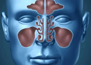 اخصائي يكتشف طريقة لعلاج التهاب الجيوب الأنفية