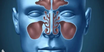 اخصائي يكتشف طريقة لعلاج التهاب الجيوب الأنفية