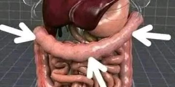 القولون العصبي.. أعراضه وطرق علاجه..