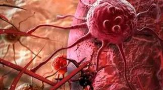 إليك كل ما تريد معرفته عن العلاج الكيميائي والإشعاعي لمرضى السرطان