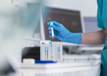 اختبار دم بسيط قد يكشف الأمراض قبل 10 سنوات من ظهور أعراضها