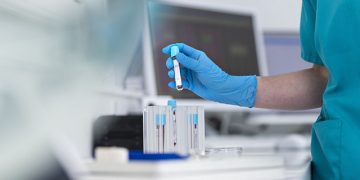 اختبار دم بسيط قد يكشف الأمراض قبل 10 سنوات من ظهور أعراضها