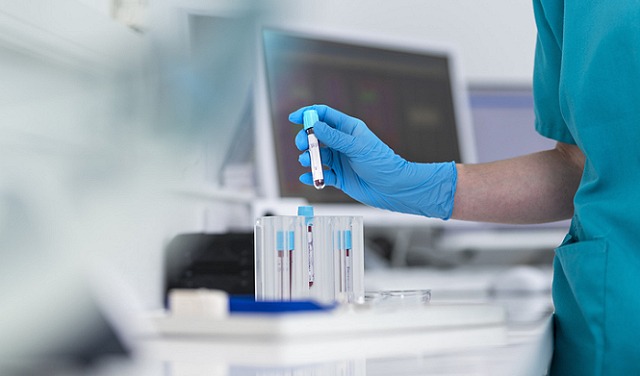 اختبار دم بسيط قد يكشف الأمراض قبل 10 سنوات من ظهور أعراضها