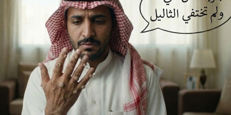 الثاليل ليس بسيطة كما تعرف ؟حقائق لا تعرفها من قبل.