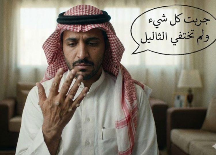 الثاليل ليس بسيطة كما تعرف ؟حقائق لا تعرفها من قبل.