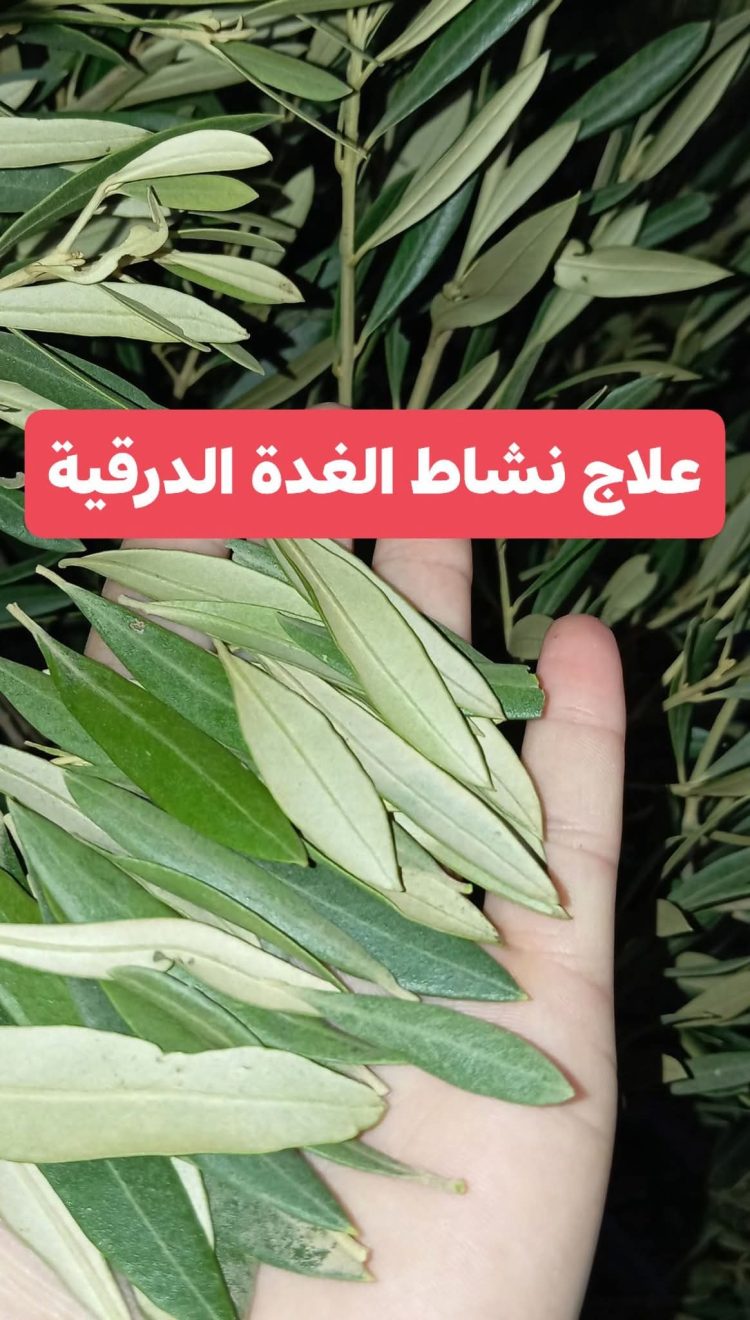 صيدلية حرمون: علاج نشاط الغدة الدرقية